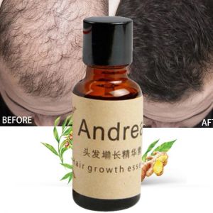 Hot Sale 20ml Essential Oils Herbal Keratin Fast Hair Growth Essence Loss Liquid Ginger Dense Fast Grow Restoration Hair Care